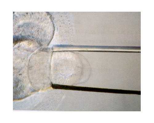 重庆代孕专业公司,重庆试管婴儿费用可以报销吗？可以使用医保扣款吗？_孕妇