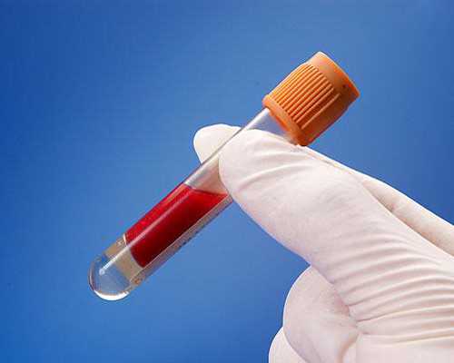 重庆市妇幼保健院生殖科哪个主管医生做试管好些？