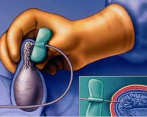 重庆专业代孕包成功,北京民间地下供卵试管机构（重庆助孕优贝贝助孕）-孕妇