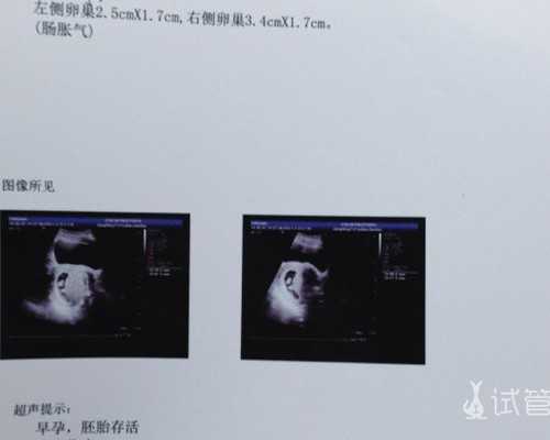 重庆试管代怀资料,重庆三代试管费用总共多少钱？