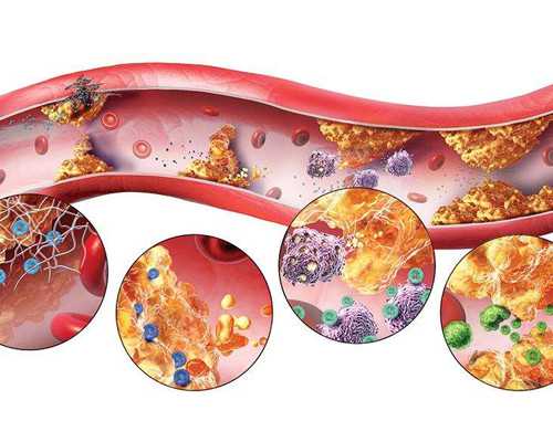 重庆中心代孕套餐,试管婴儿移植后感觉有哪些？_孕妇梦见很多小河虾生男生女