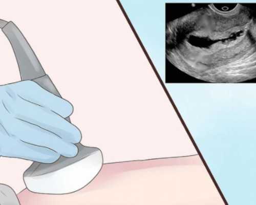 重庆有试管婴儿代孕吗|南通供卵试管包男孩费用,南通试管供卵选男孩费用