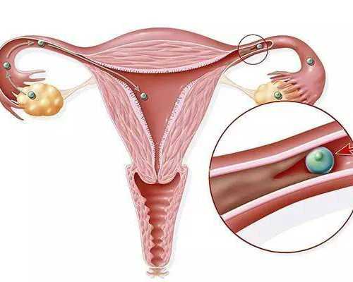 重庆失独代孕|石嘴山供卵试管婴儿的专栏列表