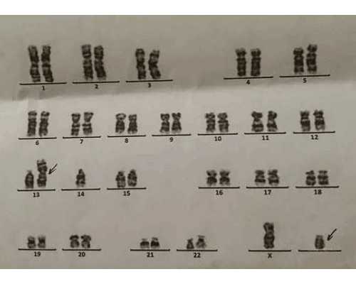 重庆30岁能试管助孕吗，重庆30岁试管助孕政策调查
