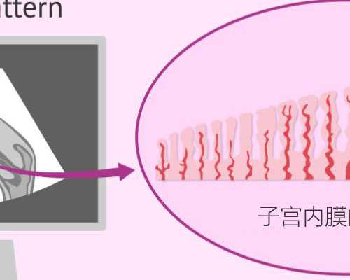 备孕期吃辣吃糖的危害*供卵代怀机构