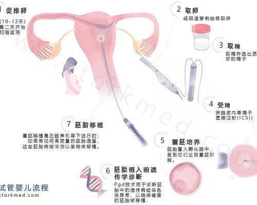 重庆试管代怀百科,艾滋病女性感染者赴美试管能促排卵吗？-深圳借卵试管婴儿