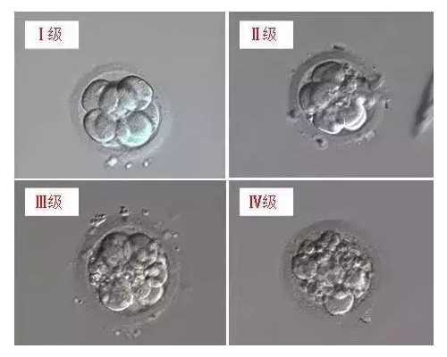 河南地区有哪些私立的机构可以做试管技术?男性做精子细菌影响试管吗?