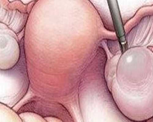 重庆代孕产子中心哪里最专业|2026
年最新呼和浩特供卵试管助孕医院排名-内附