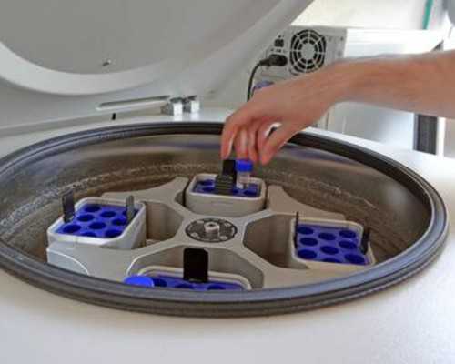 重庆供卵试管公司,重庆做试管婴儿的私立医院有吗？-内膜异位症做试管一般采