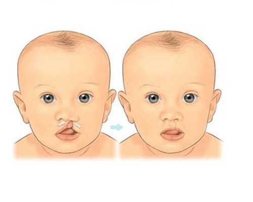 本地户籍及非重庆户籍都可以接种，但是由于九价疫苗数量有限，所以一般标准