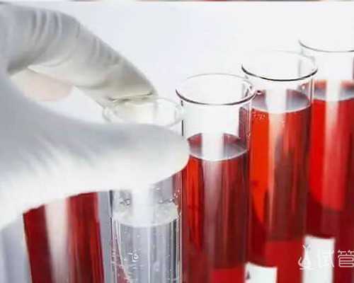 重庆找一个代孕公司,2026年在青海做试管婴儿费用大约多少？（附费用明细）