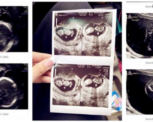 有人有重庆协和医院生殖中心试管婴儿专家出诊时间表吗？