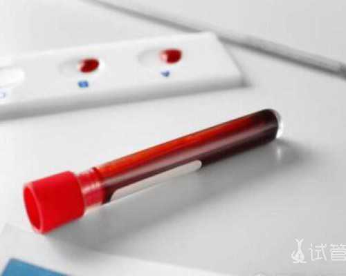 重庆有代生机构吗,重庆试管选性别费用多少？重庆试管做男女费用-降调后人工