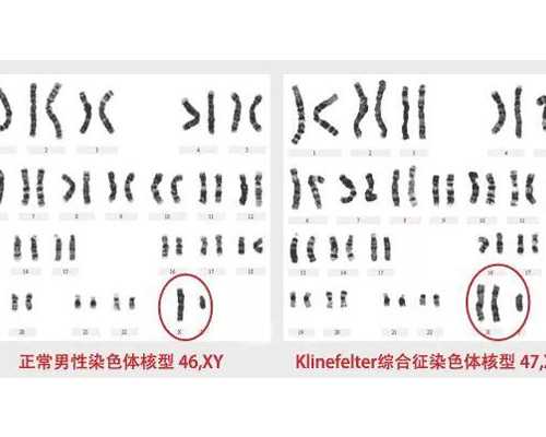 重庆代生医院,重庆哪里做试管最权威 女性得了宫颈肌瘤有什么症状表现?