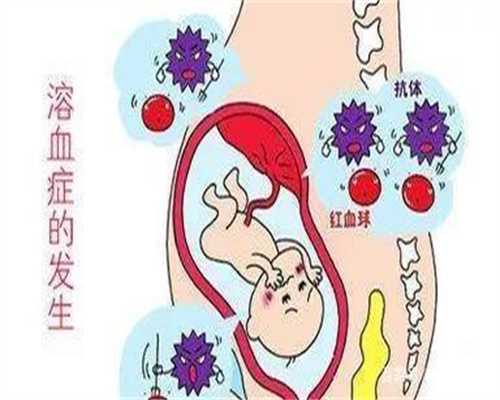台州代孕哪里找：代孕妇得了便秘和痔疮的治疗