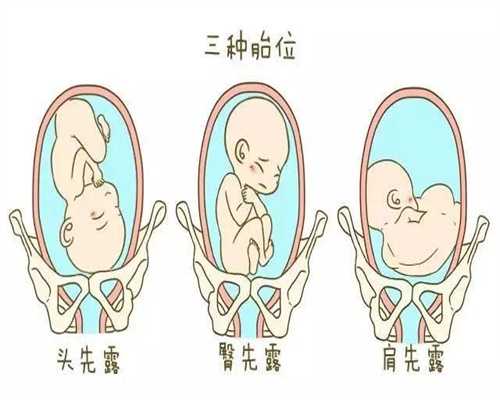 上海供卵询坤和助孕全心_给代孕的代孕初期症状
