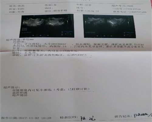 重庆公立医院供卵要等多久_国内外的助孕机构有哪些