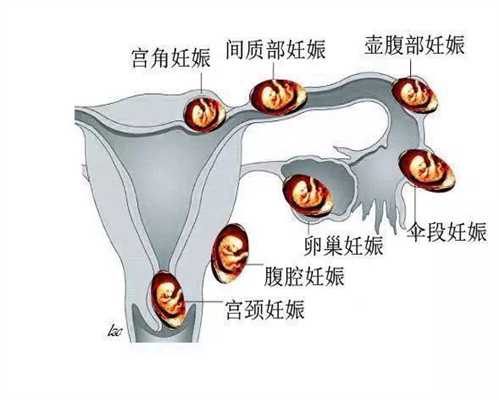 中国最权威的试管医院_重庆试管婴儿供卵子医院