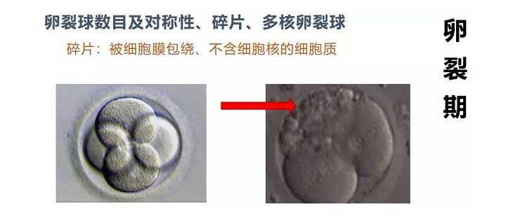 广州代生婴儿_做试管想要一次性成功,优胚移植成功率可作了解
