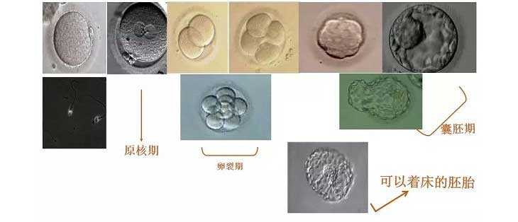 广州代生婴儿_做试管想要一次性成功,优胚移植成功率可作了解