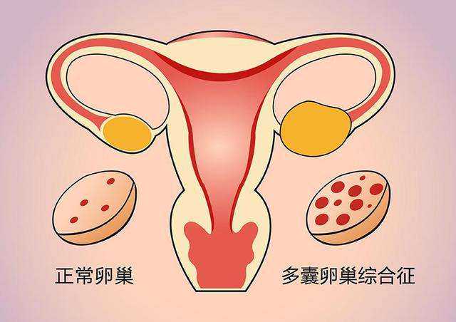 重庆助孕中心 重庆三代试管婴儿医院推荐： ‘孕囊的大小怎么看男女’